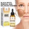 OUHOE Skin Melanin Repair Essence, Brightening And Repairing Skin Removing Darkening And Dark Spots Hydrating Essence