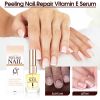 Jaysuing Nail Repair Essence Hand, Foot, Nails And Nails Repair Damaged Nails And Gray Nail Care Solution