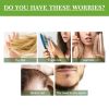 OUHOE Rosemary Oil for Hair & Scalp