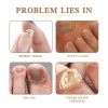 West&Month Nails Repair Oil Pen, Hand And Foot Gray Nails Clean Soft Nails Rotten Nails Thickening Toenail Care Solution