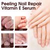 Jaysuing Nail Repair Essence Hand, Foot, Nails And Nails Repair Damaged Nails And Gray Nail Care Solution