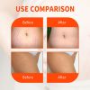 Jaysuing Scar Repair Oil, Lightens Scar Marks, Shaping Moisturizing Firming And Smoothing Skin Oil