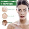 EELHOE White Spot Repair Cream Skin White Spot Melanin Repair Even Skin Tone Topical Care Cream
