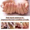 Jaysuing Nail Repair Essence Hand, Foot, Nails And Nails Repair Damaged Nails And Gray Nail Care Solution