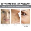 Hoygi Retinol Cream Lighten Fine Lines Lift Firming Face Skin Brightening Skin Repair Moisturizing Cream