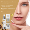 Hoygi Eye Serum Delicate, Moist, Tender, Moisturizing And Gentle Repair Serum For Skin Around The Eyes