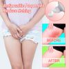 South Moon Heat Rash Treatment Cream, Alleviate The Uncomfortable Itching Clean Body Odor Care Cream For External Use Only