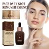 West&Month Spot Repair Serum, Lighten Face Spots Repair Dull Skin Hydrating Essence
