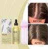 EELHOE Plant Hair Care Essential Oil Set Nourishes And Improves Hair Quality Frizz Smooth, Soft, Moist And Glossy Hair Care Oil