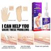 South Moon Remove Chicken Eye Lotion Extra Clear Remove Corns Skin Care Chicken Calluses Foot Pad Gram Warts