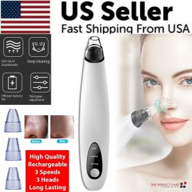 Electric Blackhead Remover - Diamond Pore Vacuum Suction White Heads (Option: Default Title)